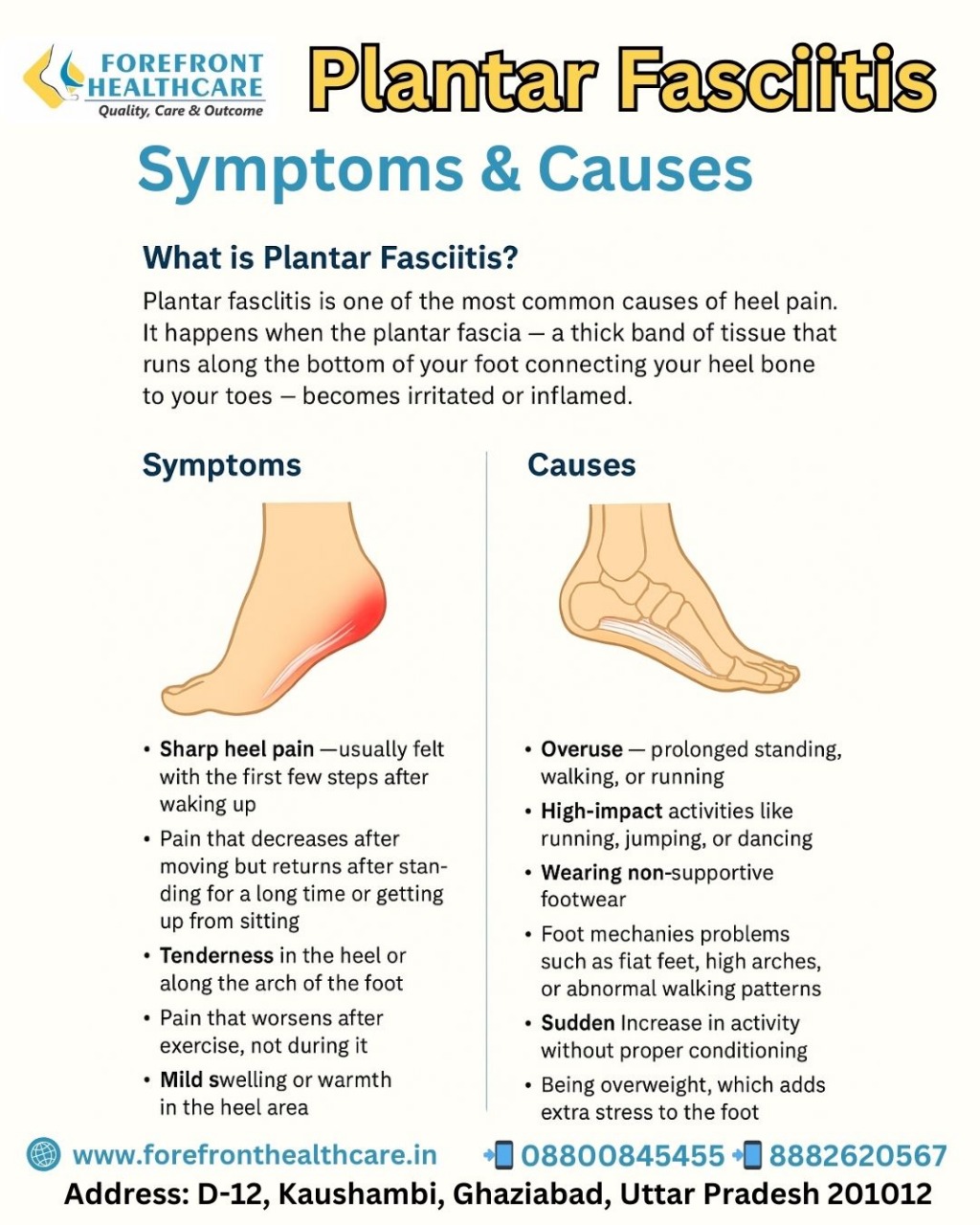 Plantar Fasciitis – Symptoms & Causes
